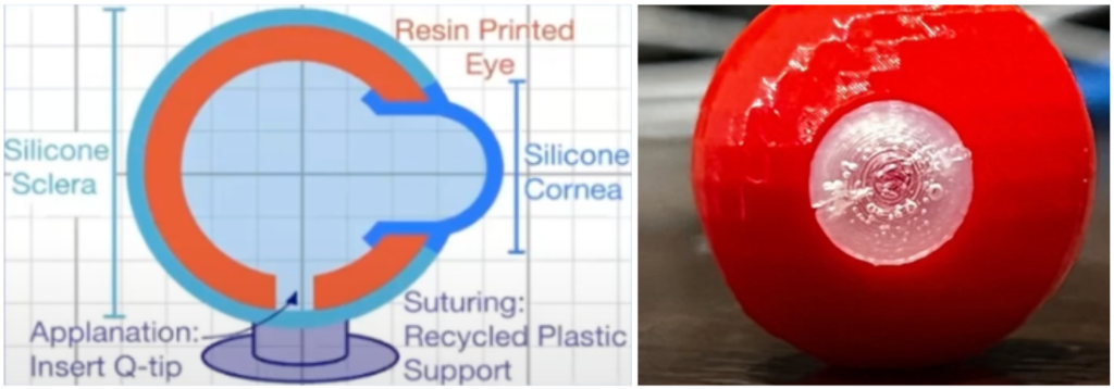 Sonia Patel's eye invention diagram